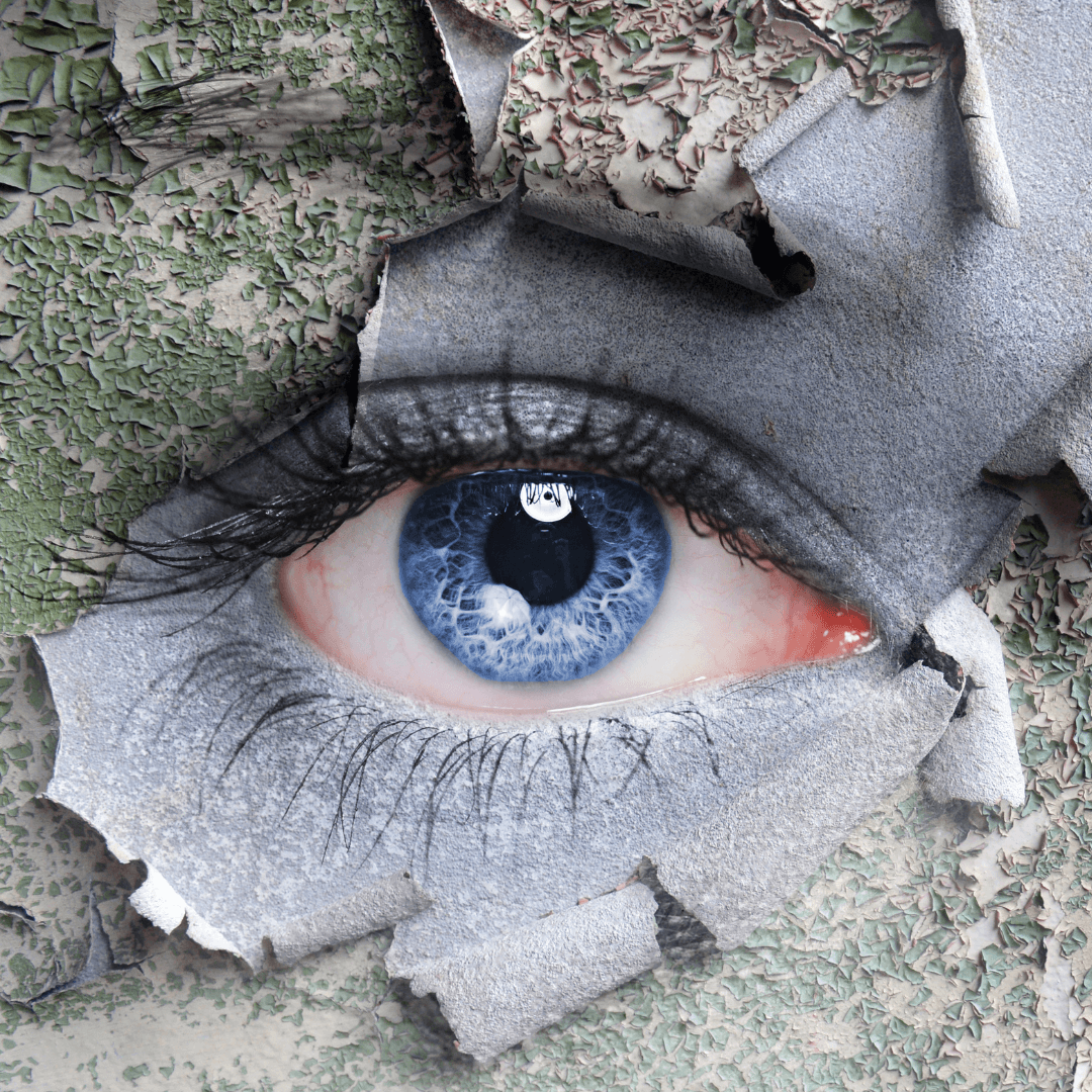 What You Need to Know About Dry Eye Benjamin Eye Institute