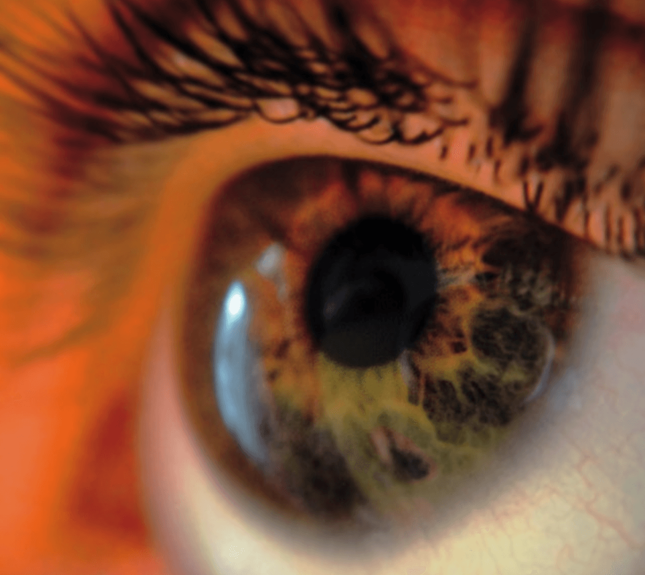 Why Your “Redness Relief” Eye Drops Aren’t Helping (and might actually be hurting)